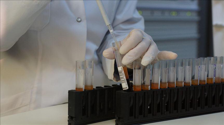 HIVde dışlanma teşhis ve tedaviyi engelliyor