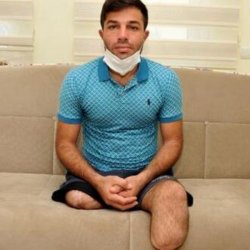 Antalya'da, iki bacağını kaybeden Ensar yardım bekliyor