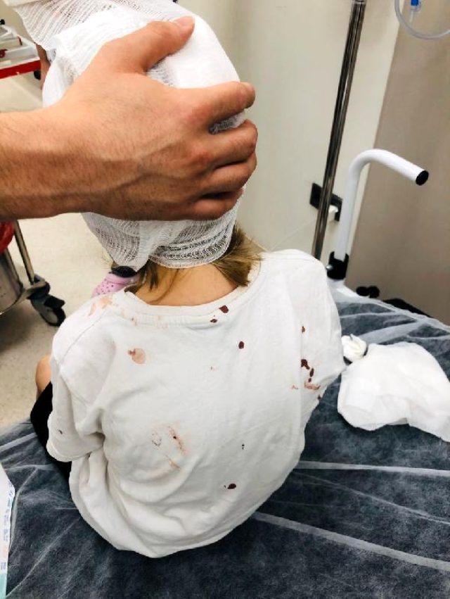 Muştalı saldırıya uğrayan 5 yaşındaki çocuğun kafatası delindi