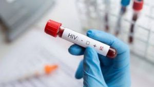 Hiv Testi Nedir?